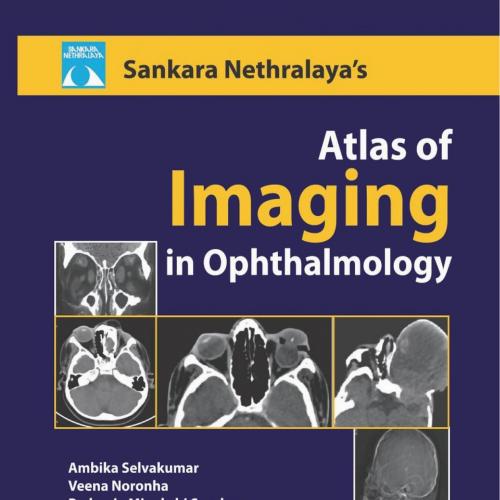 Sankara Nethralaya's Atlas of Imaging in Ophthalmology