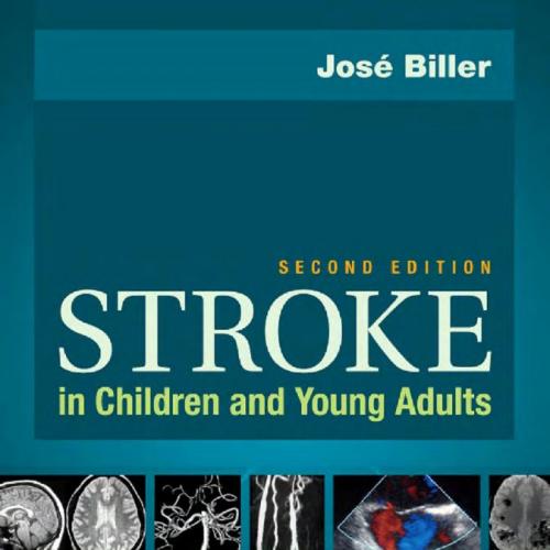 Stroke in Children and Young Adults, 2nd Edition
