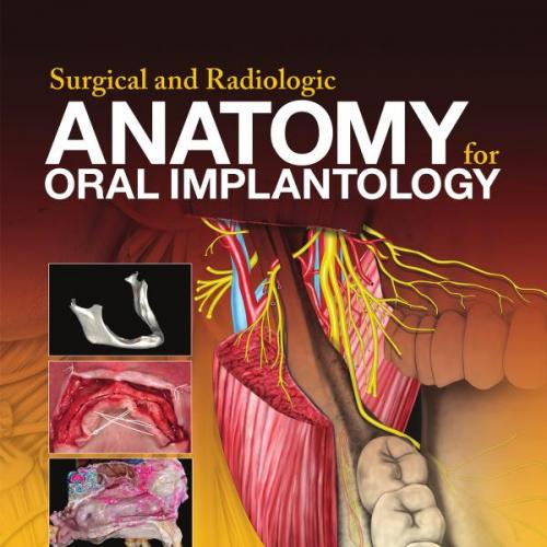 Surgical and Radiologic Anatomy for Oral Implantology, 1E (2014)