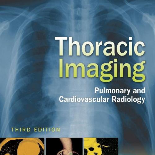 Thoracic Imaging Pulmonary and Cardiovascular Radiology