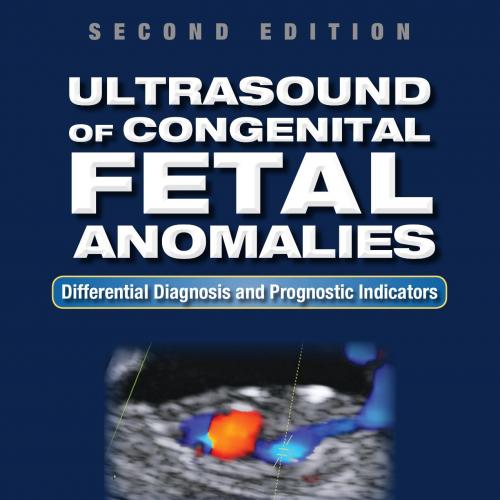 Ultrasound of Congenital Fetal Anomalies Differential Diagnosis and Prognostic Indicators 2e