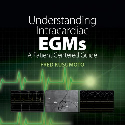 Understanding Intracardiac EGMs A Patient Centered Guide - Fred Kusumoto