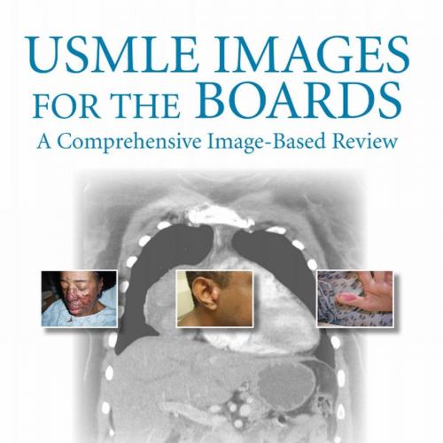 USMLE Images for the Boards A Comprehensive Image-Based Review, 1e