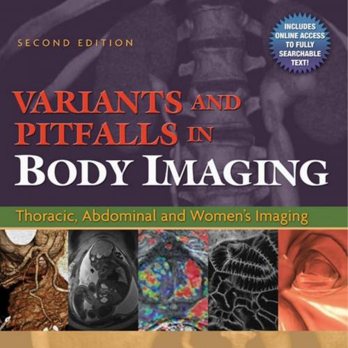 Variants and Pitfalls in Body Imaging-Thoracic, Abdominal and Women's Imaging, 2e - Wei Zhi