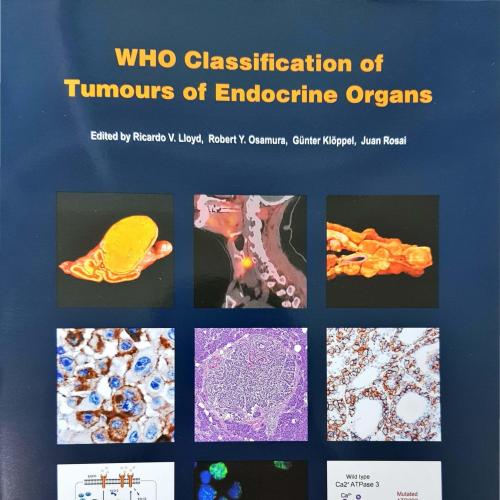WHO Classification of Tumours of Endocrine Organs 4th - Wei Zhi