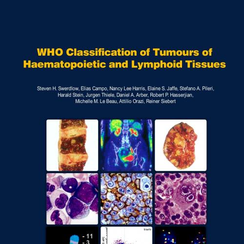 WHO Classification of Tumours of Haematopoietic and Lymphoid Tissues V2 4th - Wei Zhi