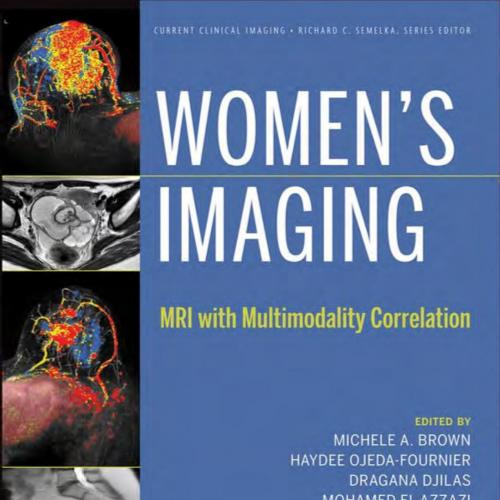 Women’s Imaging_ MRI with Multimodality Correlation - Michele A. Brown, Haydee Ojeda-Fournier, Dragana Djilas, Mohamed El-Azzazi, Richard C. Semelka