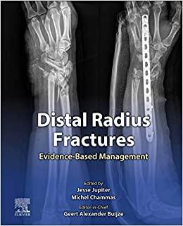 Distal Radius Fractures Evidence-Based Management 1st Edition