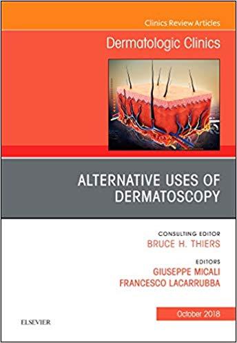 Alternative Uses of Dermatoscopy