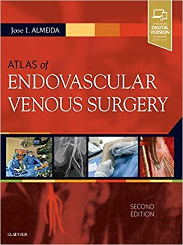 Atlas of Endovascular Venous Surgery 2nd Edition