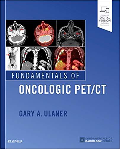 Fundamentals of Oncologic PETCT (Fundamentals of Radiology) 1st Edition