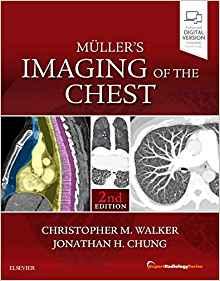 Muller’s Imaging of the Chest Expert Radiology Series 2nd Edition