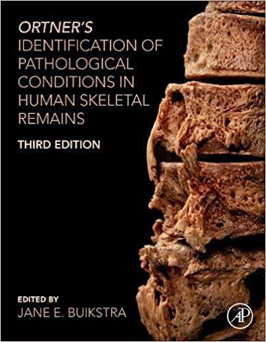 Ortners Identification of Pathological Conditions in Human Skeletal Remains 3rd Edition