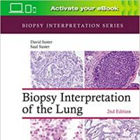 Biopsy Interpretation of the Lung (Biopsy Interpretation Series) 2nd Edition
