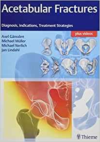 Acetabular Fractures Diagnosis, Indications, Treatment Strategies (包含视频)