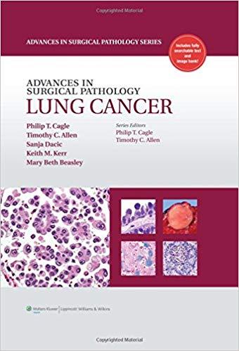 Advances in Surgical Pathology - Lung Cancer+CHM版