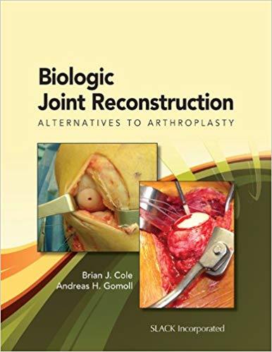Biologic Joint Reconstruction