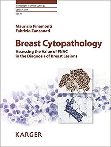 Breast Cytopathology - Assessing the Value of FNAC in the Diagnosis of Breast Lesions