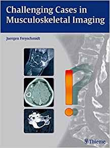 Challenging Cases in Musculoskeletal Imaging [Thieme]