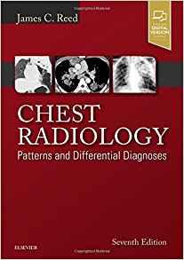 Chest Radiology Patterns and Differential Diagnoses 7th Edition