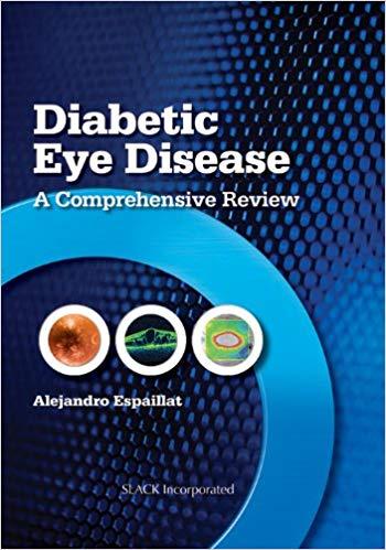 Diabetic Eye Disease - A Comprehensive Review