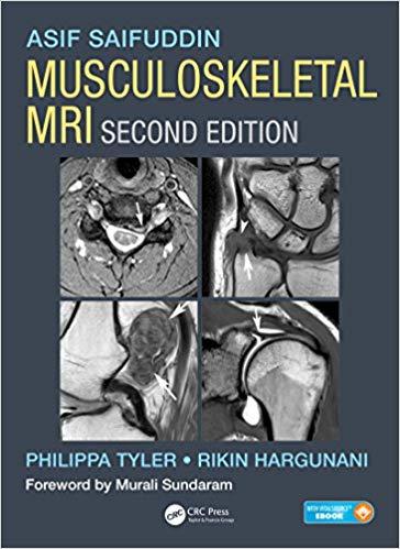 Musculoskeletal MRI, 2nd Edition