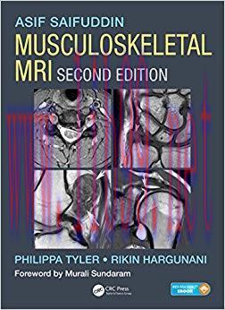 (PDF)Musculoskeletal MRI 2nd Edition