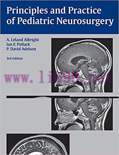 (PDF)Principles and Practice of Pediatric Neurosurgery 3rd Edition