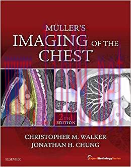 (PDF)Muller’s Imaging of the Chest E-Book: Expert Radiology Series