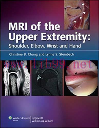(PDF)MRI of the Upper Extremity: Shoulder, Elbow, Wrist and Hand 1st Edition