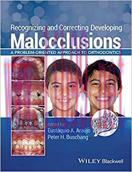 (PDF)Recognizing and Correcting Developing Malocclusions: A Problem-Oriented Approach to Orthodontics 1st Edition