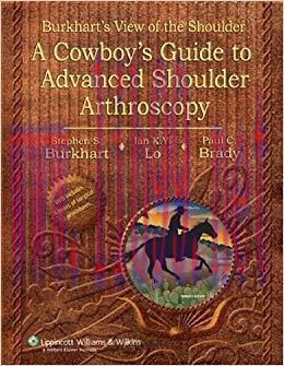 (PDF)Burkhart’s View of the Shoulder: A Cowboy’s Guide to Advanced Shoulder Arthroscopy 1st Edition