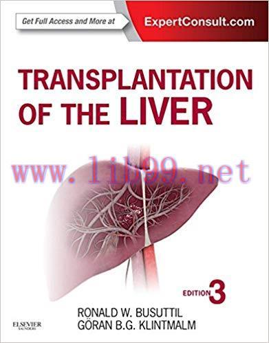 (PDF)Transplantation of the Liver E-Book 3rd Edition