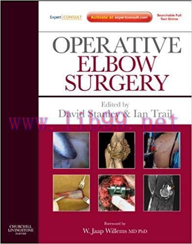 (PDF)Operative Elbow Surgery E-Book: Expert Consult: Online and Print 1st Edition