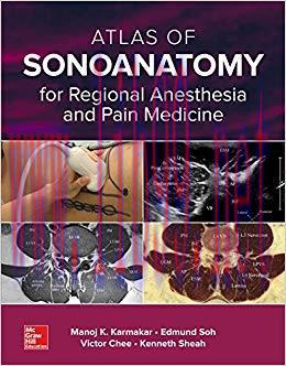 (PDF)Atlas of Sonoanatomy for Regional Anesthesia and Pain Medicine 1st Edition