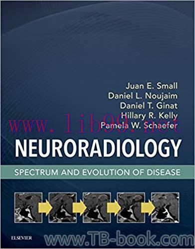 Neuroradiology: Spectrum and Evolution of Disease 1st Edition by Juan E. Small
