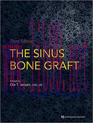 [PDF]The Sinus Bone Graft, Third Edition