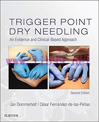 [PDF]Trigger Point Dry Needling 2nd Edition E-Book