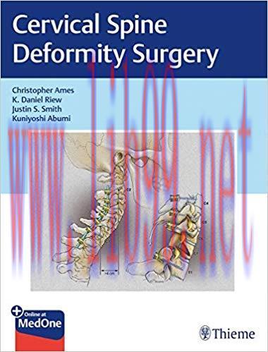 [PDF]Cervical Spine Deformity Surgery