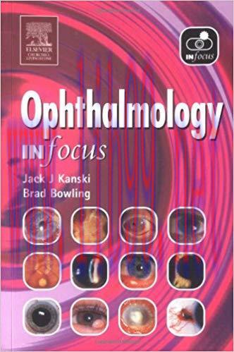 [PDF]Ophthalmology In Focus