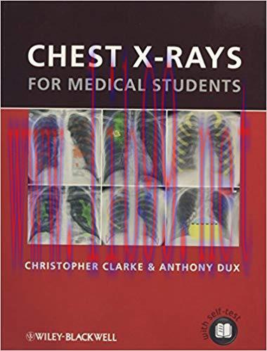 [PDF]Chest X-rays for Medical Students