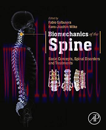 [PDF]Biomechanics of the Spine: Basic Concepts, Spinal Disorders and Treatments