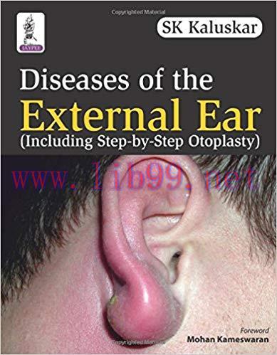 [PDF]Diseases of the External Ear (Including Step-by-Step Otoplasty)