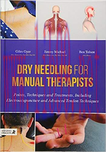 [PDF]Dry Needling for Manual Therapists