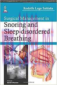 [PDF]Surgical Management in Snoring and Sleep-disordered Breathing