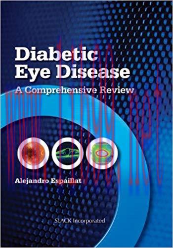 [PDF]Diabetic Eye Disease - A Comprehensive Review