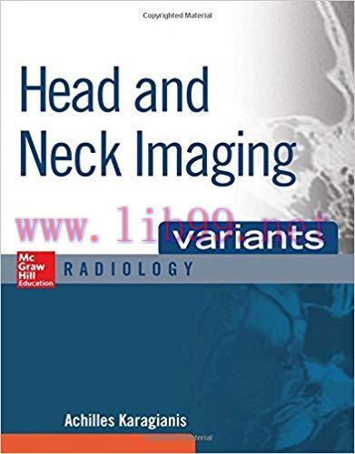 [PDF]HEAD AND NECK IMAGING VARIANTS