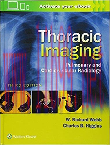 [PDF]Thoracic Imaging Pulmonary and Cardiovascular Radiology，3rd