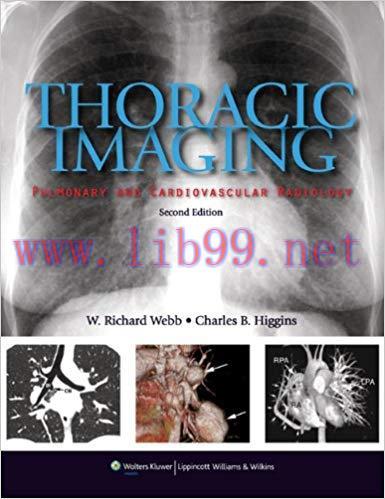 [PDF]Thoracic Imaging - Pulmonary and Cardiovascular Radiology, 2nd Edition