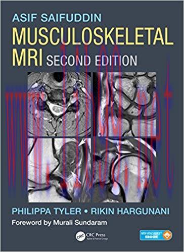 [PDF]Musculoskeletal MRI, 2nd Edition
